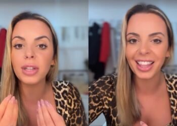 Jéssica Vieira faz procedimentos estéticos ao rosto e mostra resultado aos fãs