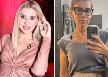 Mais magra, Mónica Sintra mostra corpo ‘real’ e assume: “Tenho excesso de pele…”